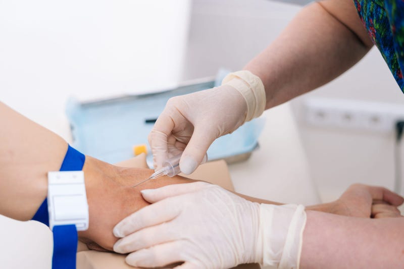 Close-up of hand of man giving blood for biochemical blood testing.