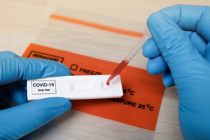 Covid-19 Anti-Body tests