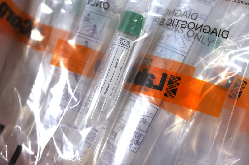 Coronavirus testing kits