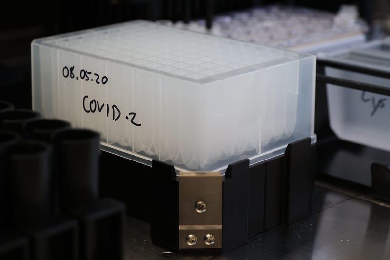Coronavirus tests in lab