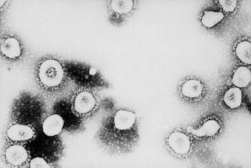 This undated handout photo from the Centers for Disease Control and Prevention (CDC) shows a microscopic view of the Coronavirus at the CDC in Atlanta, Georgia