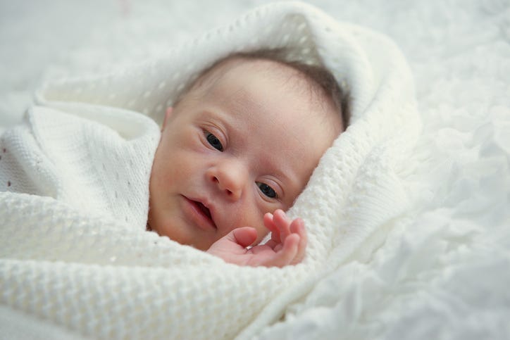 Down syndrome baby