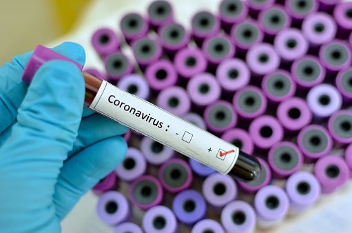 Coronavirus being tested in a lab