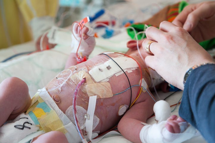 Child intensive care, mother and son