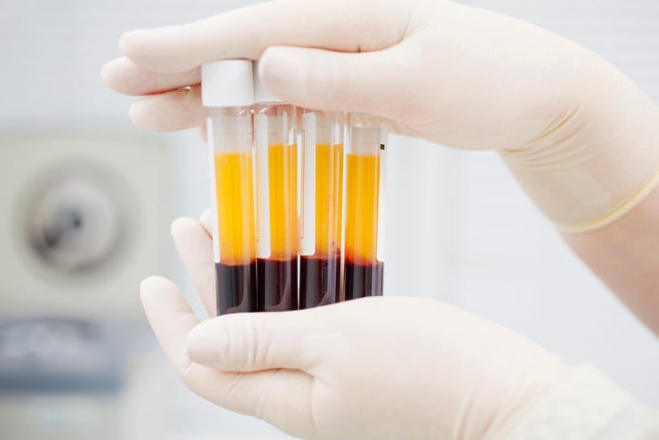 Blood Plasma