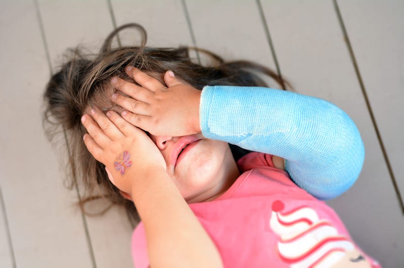 Girl with broken arm