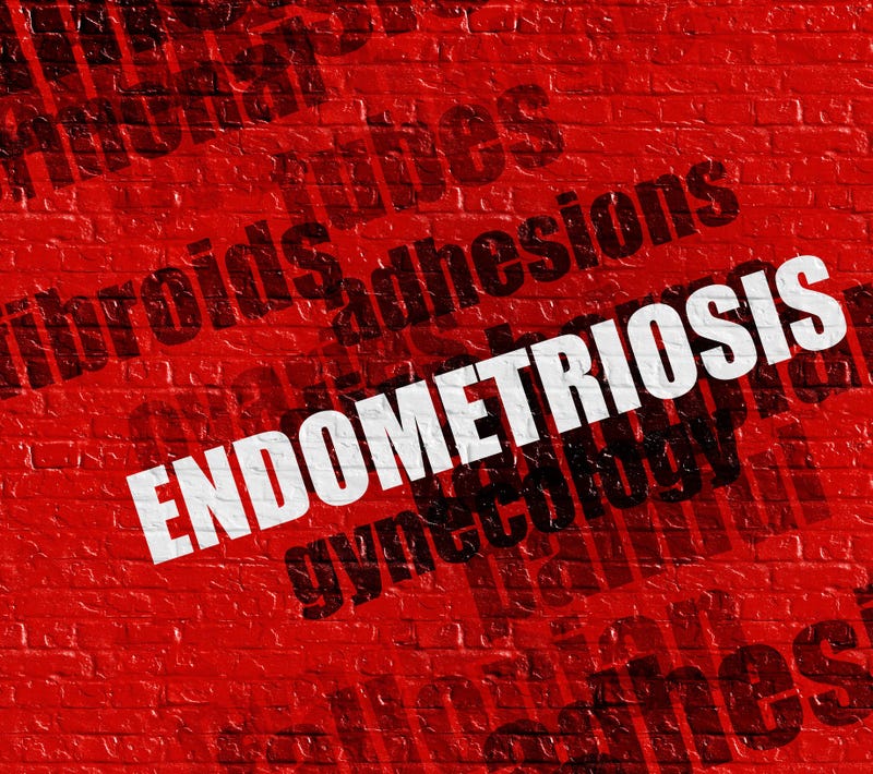 Endometriosis