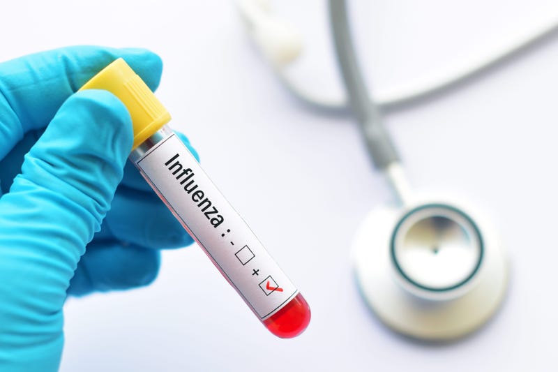 Flu