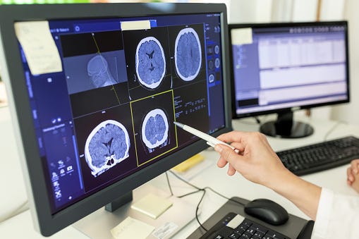 Physician looking at a brain scan CT report