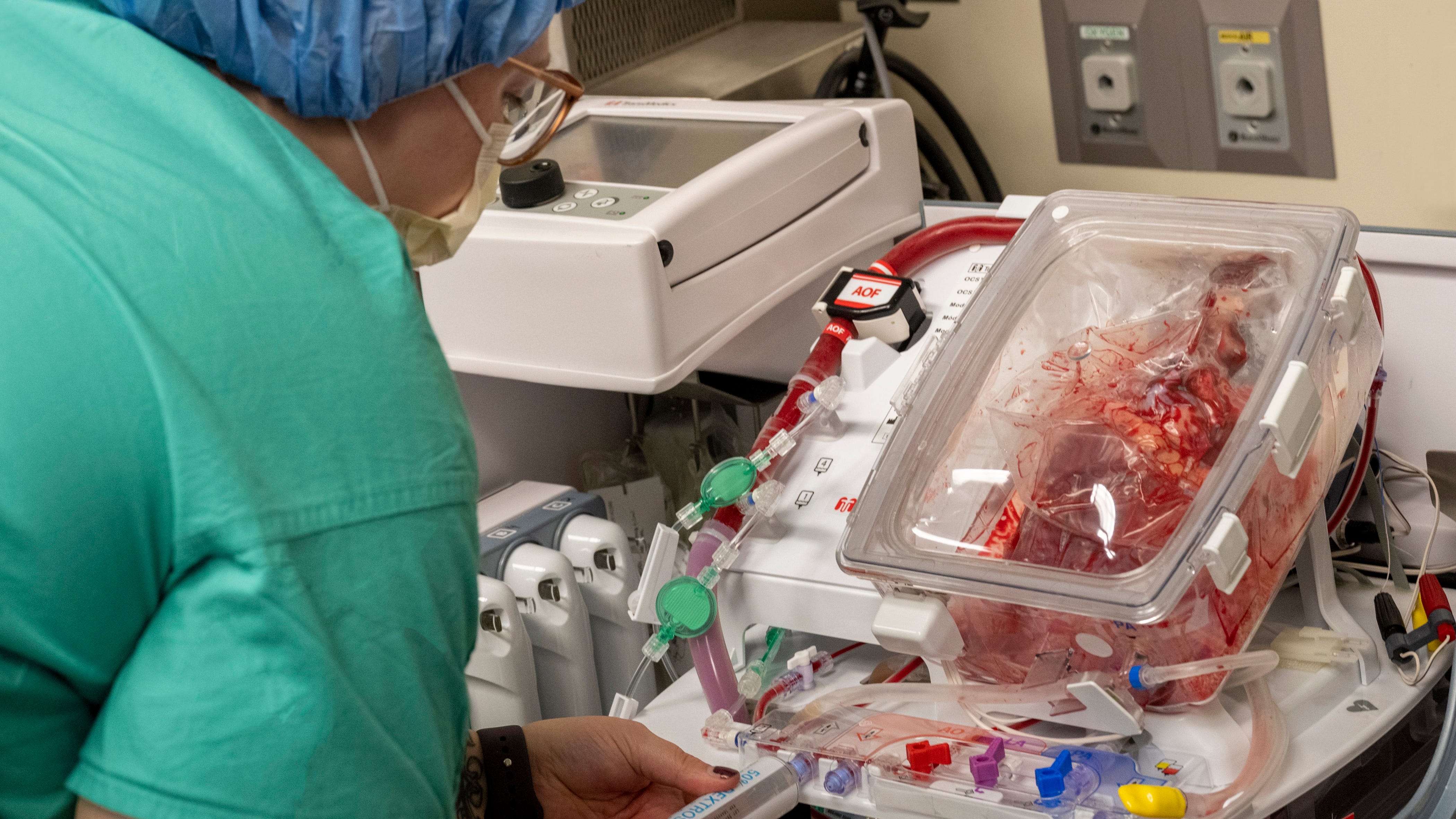 'Heart in a Box' tech could be game-changer for transplants