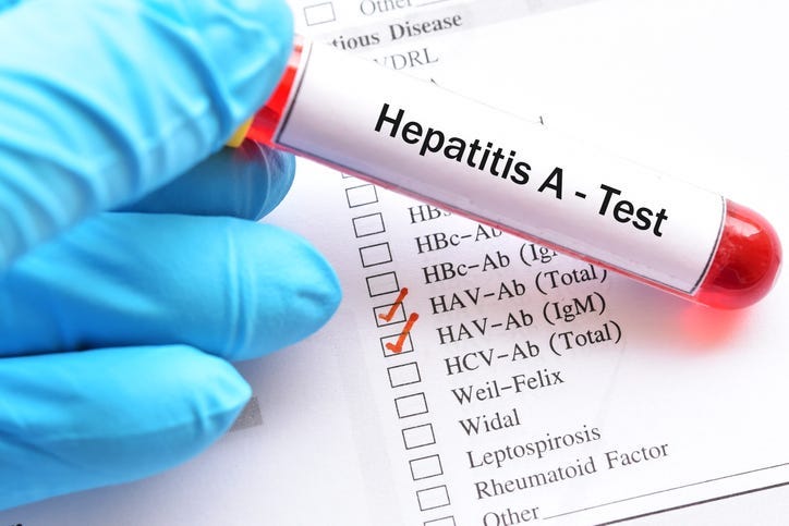 hepatitis A