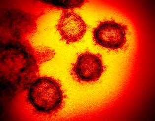 FILE - This undated electron microscope image made available by the U.S. National Institutes of Health in February 2020 shows the Novel Coronavirus SARS-CoV-2. (NIAID-RML via AP)