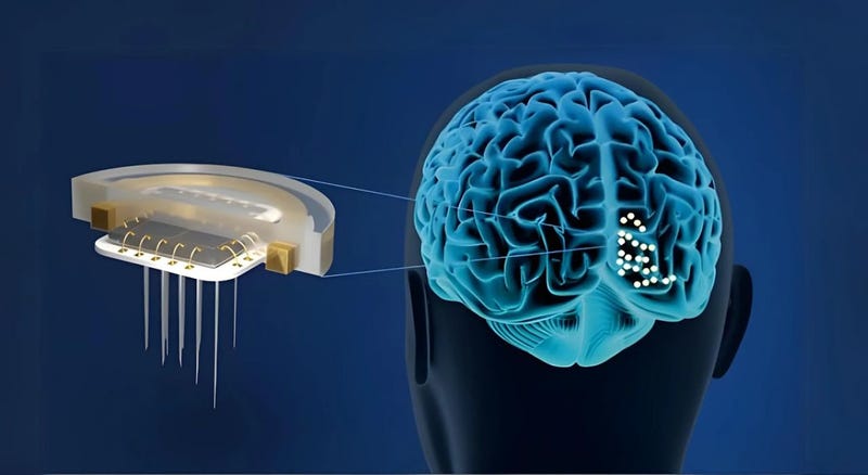 illustration of Intracortical Visual Prosthesis