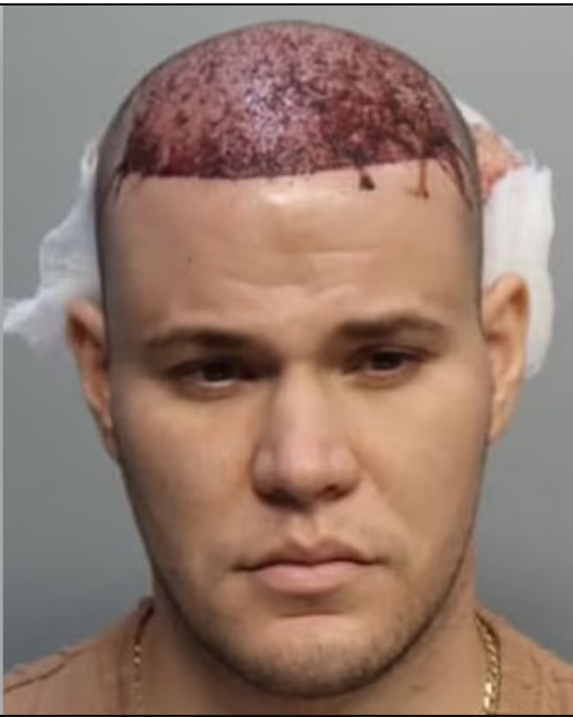Eugenio Ernesto Hernandez-Garnier, 27, seen in mugshot (Miami-Dade Corrections & Rehabilitation)