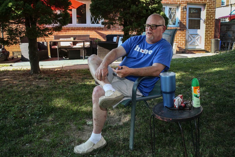 Federal drug testing rules led to problems for Todd Douglas, a medical marijuana patient and Philadelphia Gas Works employee. But he didn’t want to stop using cannabis to treat his pain.