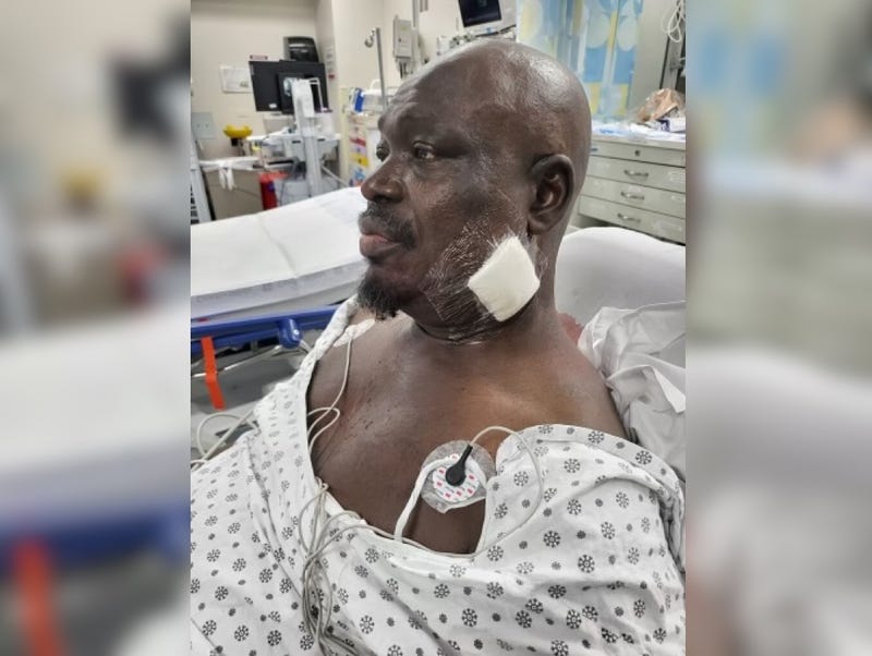 The driver, a 17-year veteran of the MTA, was hospitalized in stable condition with a "deep laceration" to his neck, according to TWU Local 100
