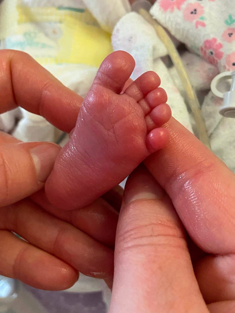 Madison Scott's little foot being gently massaged by her mom