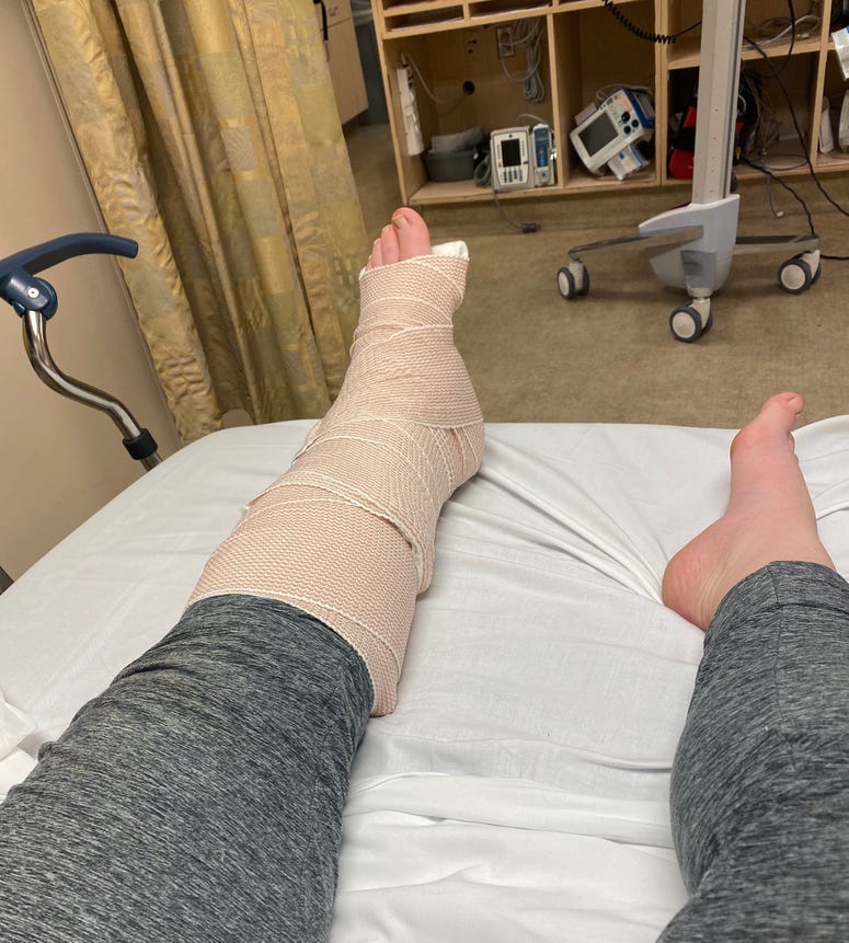 brokenleg