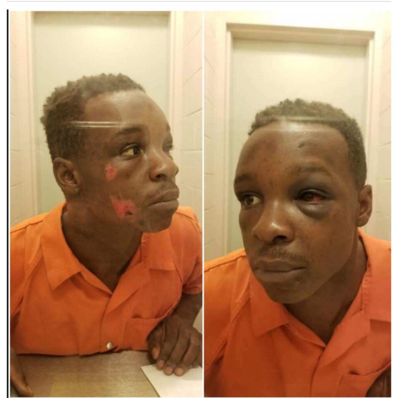 Roderick Walker is photographed in jail following confrontation with deputies in Clayton County