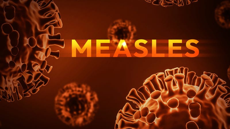 Measles virus and disease outbreak concept design - stock photo