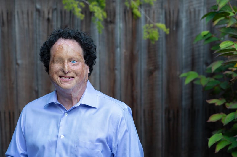 Joshua A. Miele won the MacArthur Foundation fellowship for his inventions that help blind people.