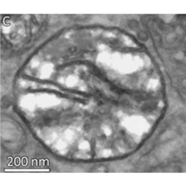 Henneguya salminicola is a multicellular organism, but it doesn't need oxygen to breathe, scientists say.