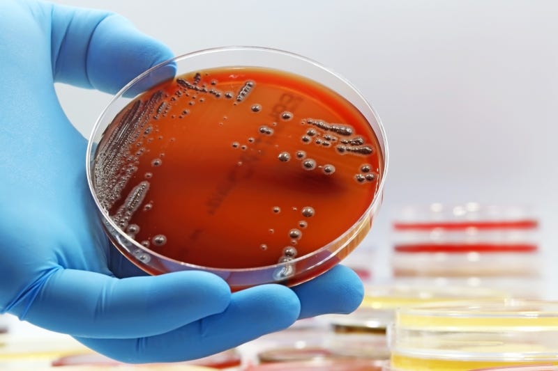 gloved hand with Petri dish
