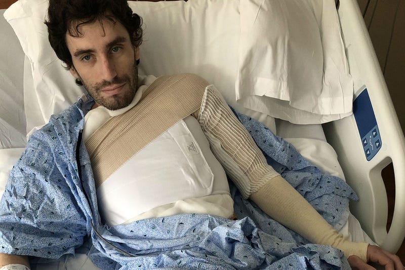 Ray Mullen has third-degree burns on 30 percent of his body