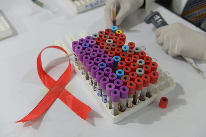 Researchers have successfully eliminated HIV from the DNA of infected mice, a promising step toward a cure for the nearly 37 million people living with the virus.