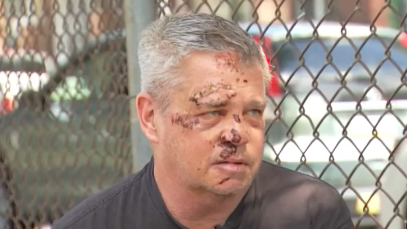 NBC10 spoke with the victim, 62-year-old Scott Harris, who said he was near his home when he was brutally beaten.