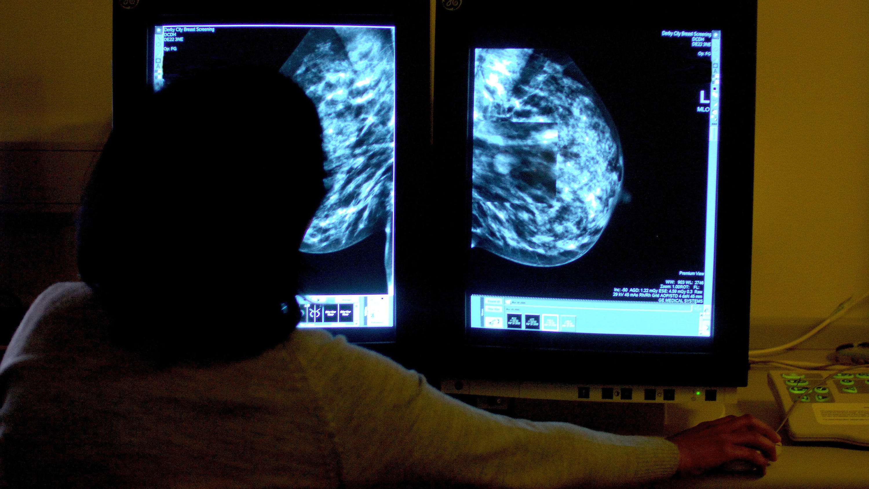 Pennsylvania expands access to breast cancer screenings