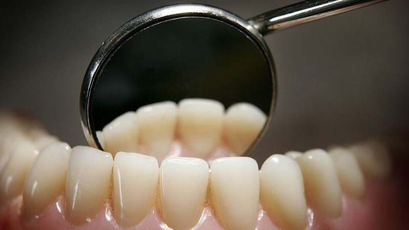  Teeth on a model denture set are reflected in a dental mirror on April 19, 2006 in Great Bookham, England.
