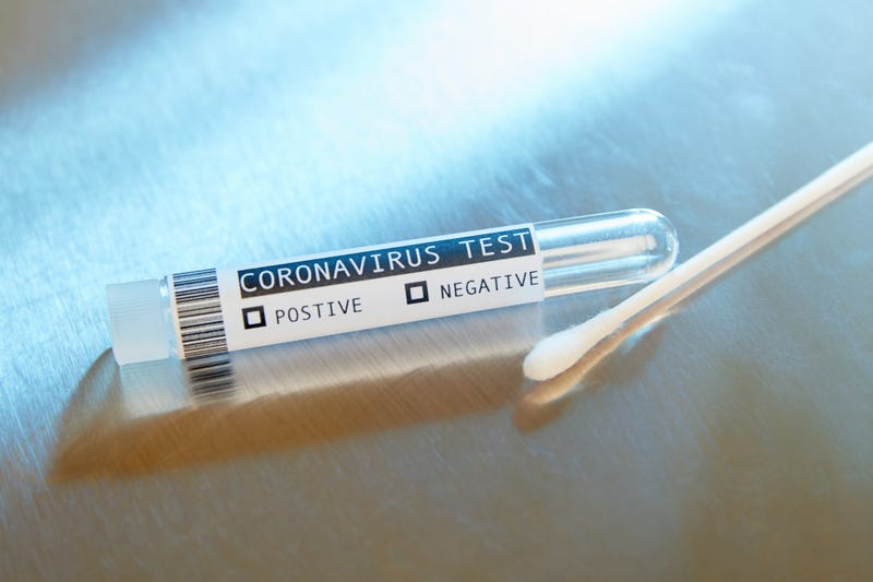 Covid-19 Coronavirus test on stainless steel surface table
