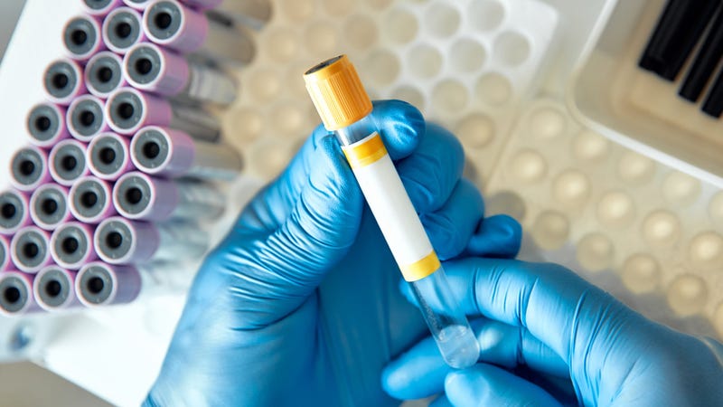 Laboratory tech handling blood test tubes  - stock photo