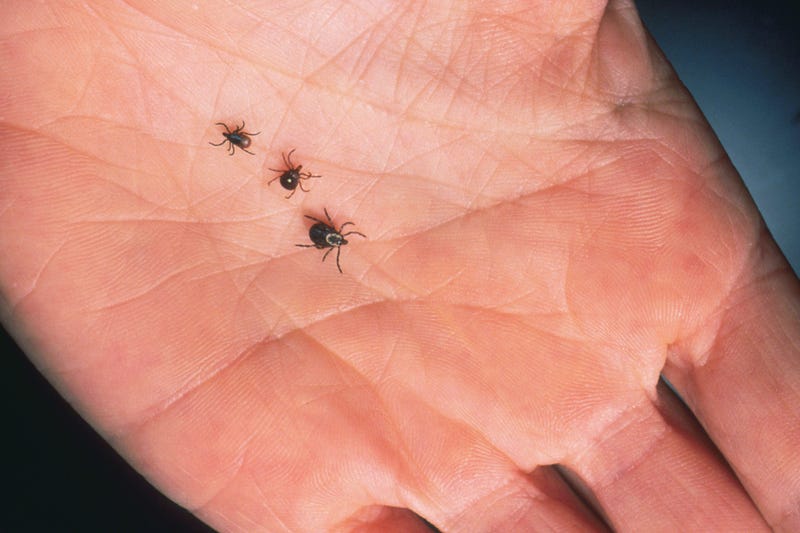 A close-up of an adult female deer tick, dog tick, and a lone star tick are shown June 15, 2001, on the palm of a hand.