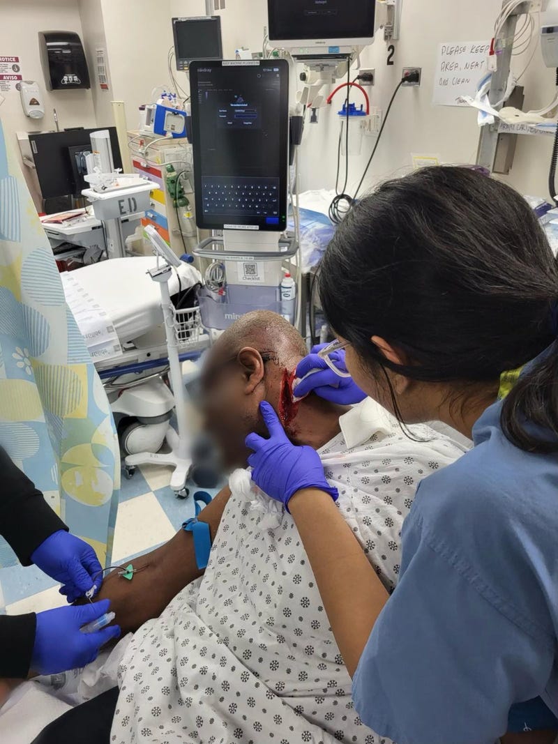 The transit workers' union said 34 stitches were need to close a "gaping wound"