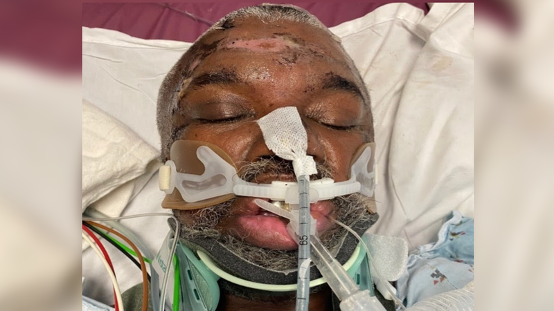 Photo of an unknown man released Feb. 4 by Harbor-UCLA Medical Center. The man is unidentified and health officials are asking the public's help in finding out who he is.