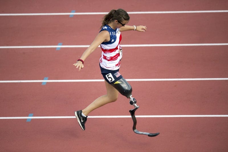 WomanVeteranProsthetic